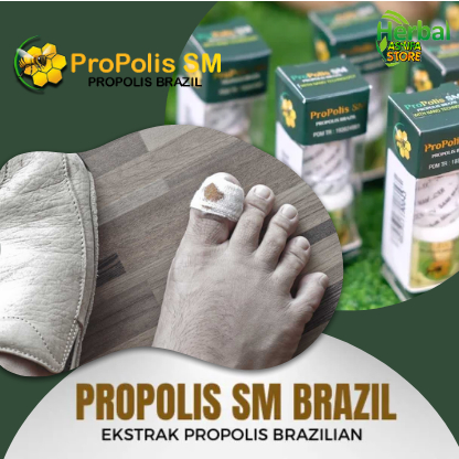 Obat Cantengan Jempol Kaki, Pembersih Jamur Kuku Jempol Kaki - Obat Tetes Penghilang Jamur Kuku, Kuk