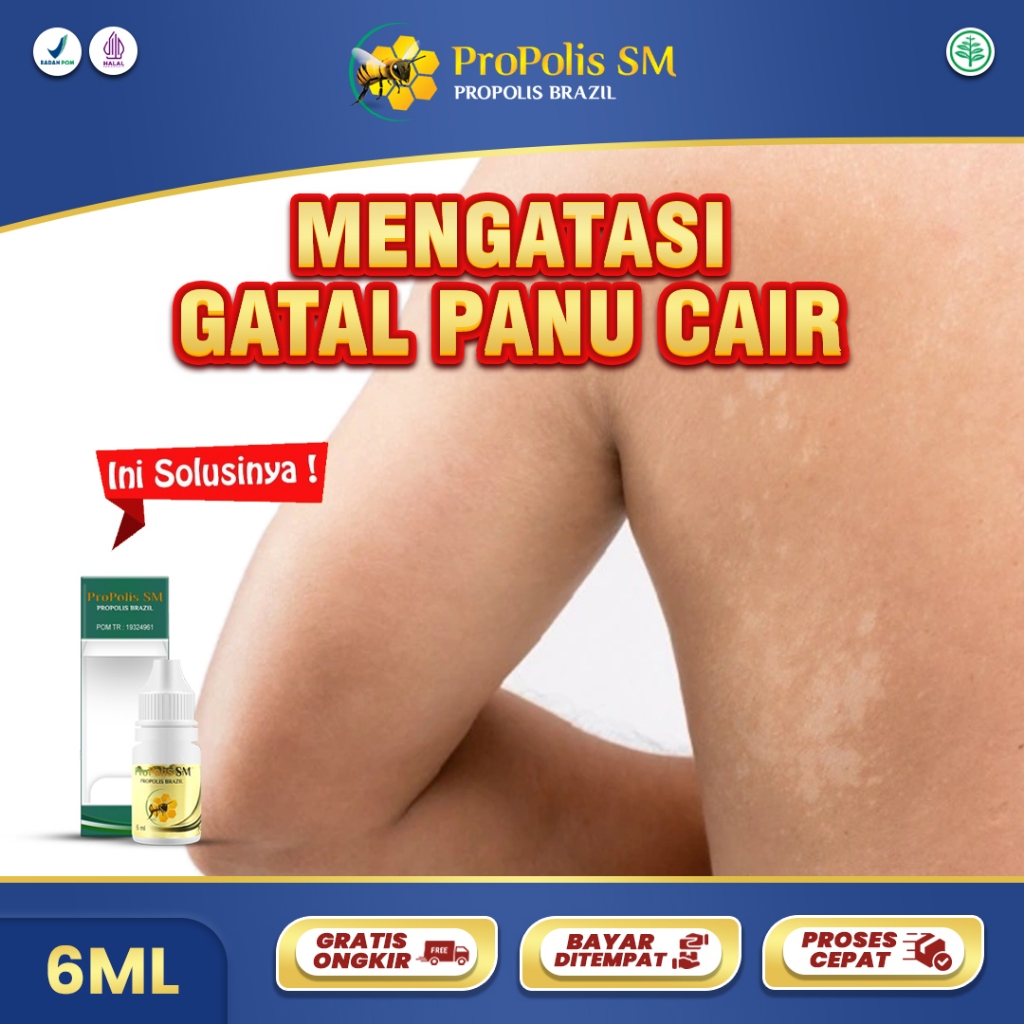 Obat Panu Cair - Obat Pengilang Panu Bercak Putih Di Kulit - Herbal Panu Infeksi Jamur Kurap Kudis