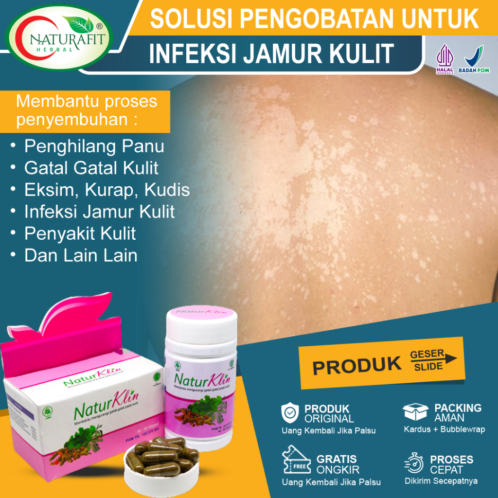 Obat Panu Paling Ampuh Alergi Kulit Gatal Kadas Kurap penghilang Panu Panuan Dermatitis Bercak Putih