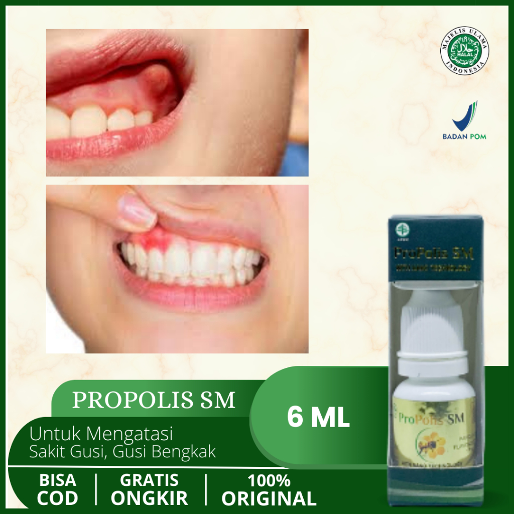 Obat Sakit Gusi, Gusi Bengkak, Gusi Bernanah, Gusi Berdarah, Gusi Turun, Radang Gusi, Gusi Ngilu, Ab