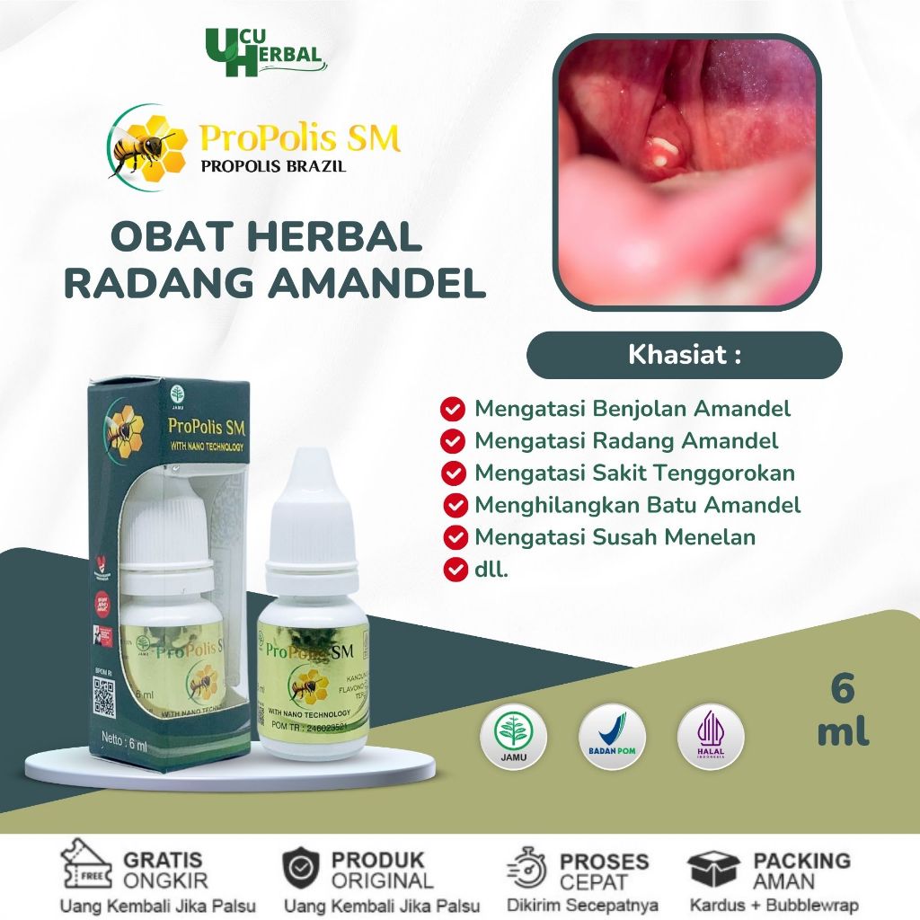 Obat Radang Amandel, Obat Batu Amandel, Nyeri Temggorokan, Sakit Saat Menelan, Amandel Menahun, Obat