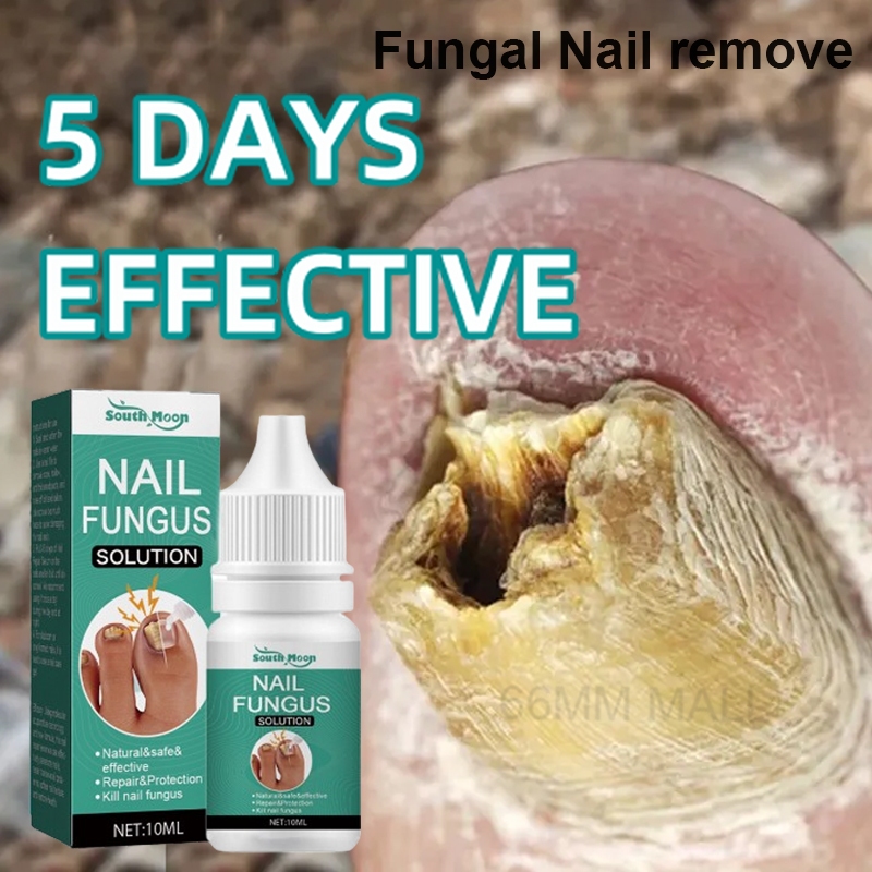 obat jamur kuku obat kuku rusak obat kuku cantengan 10ml nail repair essence perawatan kuku Obat Can