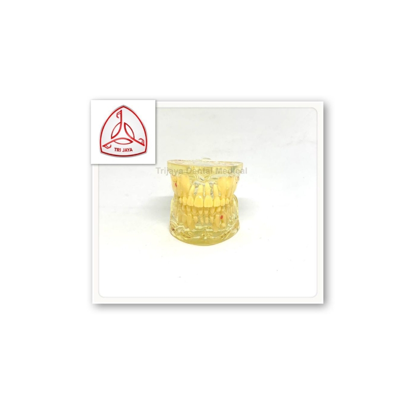 Trijaya Dental Medical Model Gigi konservasi #4002/ Phantum gigi konservasi