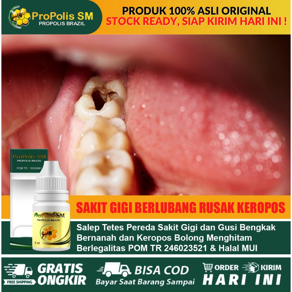 Obat Sakit Gigi Berlubang Obat Gigi Rusak, Gigi Keropos Hitam, Obat Gigi Bolong, Obat Gigi Berlubang