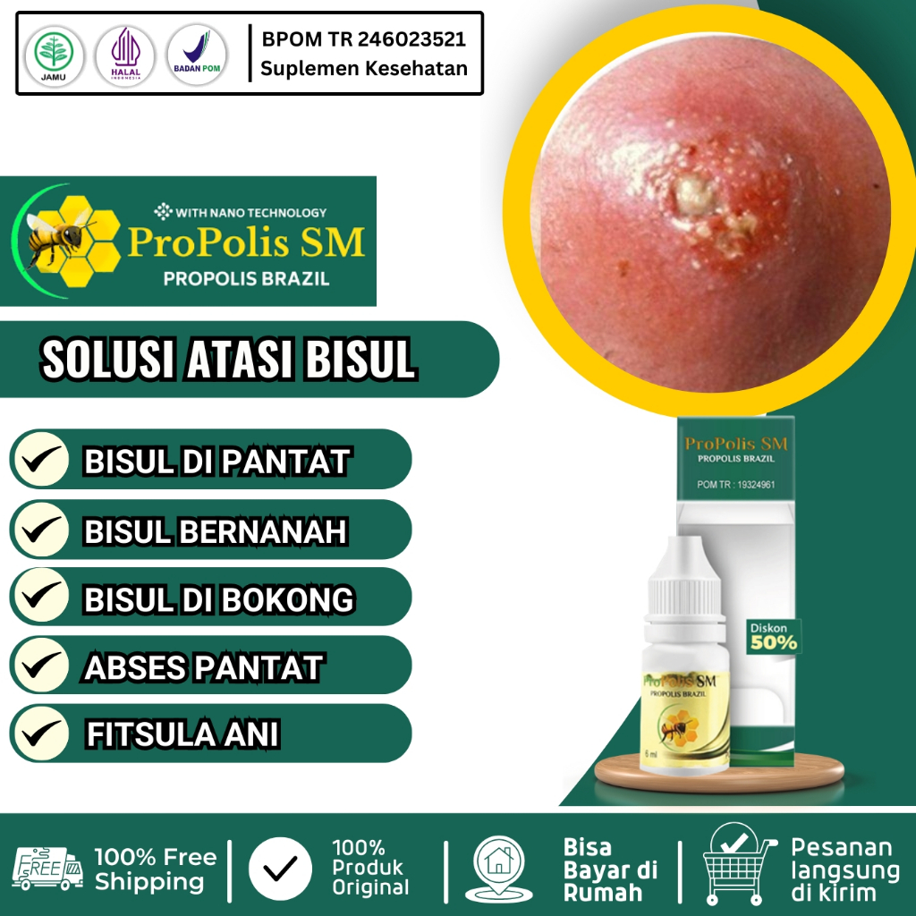 Obat Bisul, Obat Bisul Di Pantat Bernanah Bisul Di Bokong Ketiak Di Kelamin Abses Pantat Untuk Anak 