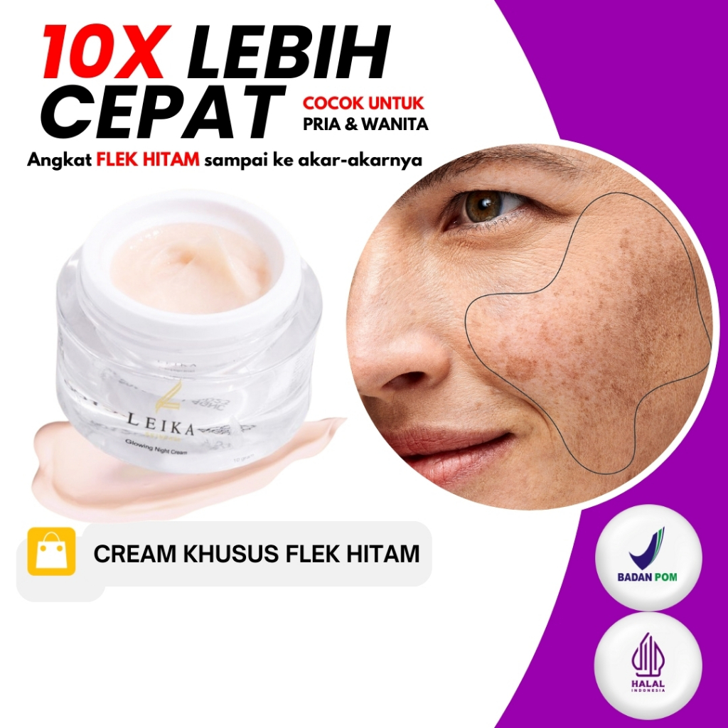 KRIM PENGHILANG FLEK BERAT TEBAL DAN PARAH SALEP FLEK MELASMA/CREAM FLEK HITAM BANDEL SALEP FLEK - S