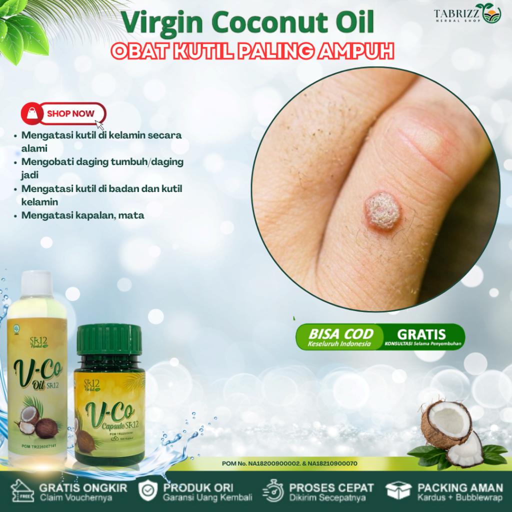 Obat Kutil Paling Ampuh, Obat Kutil Di Leher, Obat Papiloma, Obat Papiloma Di Wajah, Obat Papiloma, 