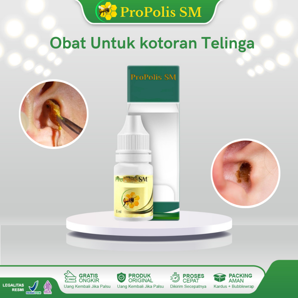 Obat Kotoran Telinga Keras Penghancur Kotoran Telinga Keras Kotoran Telinga Menumpuk Kotoran Telinga