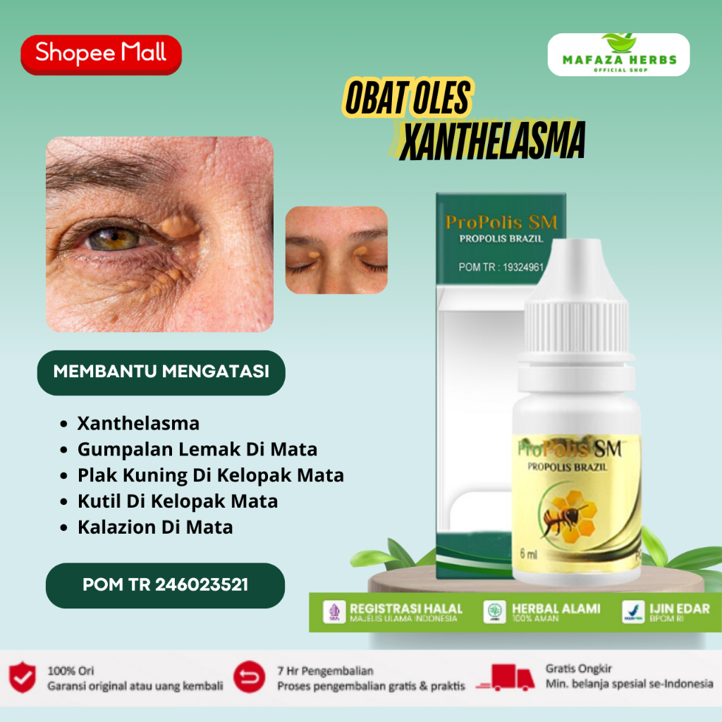 Propolis SM Obat Xanthelasma Gumpalan Lemak di Kelopak Mata Plak Kuning Kutil Di Kelopak Mata - 6ml