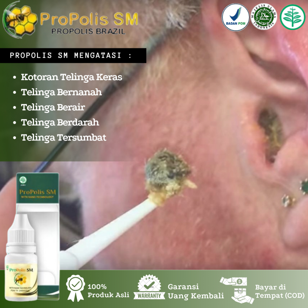 Obat Tetes Kotoran Telinga, Kotoran Telinga Keras, Pelunak Kotoran Telinga, Kotoran Telinga Tersumba
