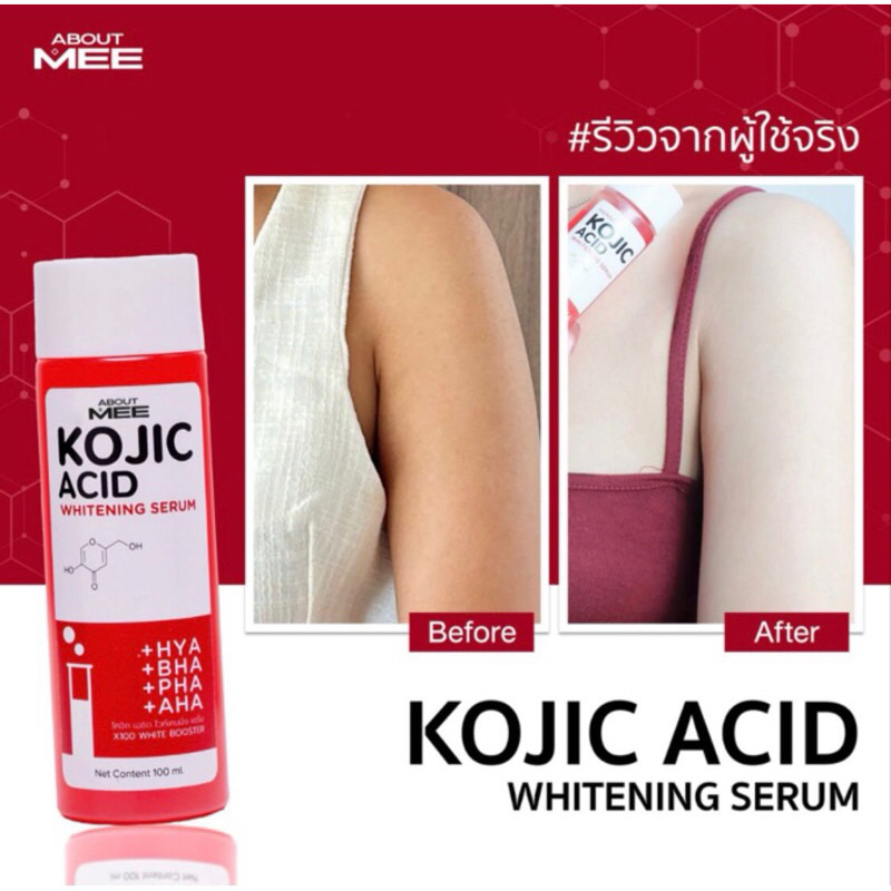 kojic acid whitening serum