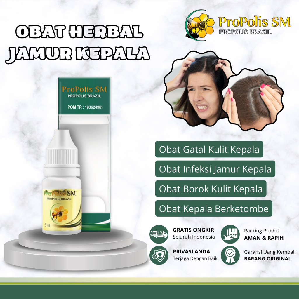 Obat Jamur Kulit Kepala, Obat Kepala Berketombe, Obat Ketombe Berkerak dan Kering, Obat Kulit Kepala