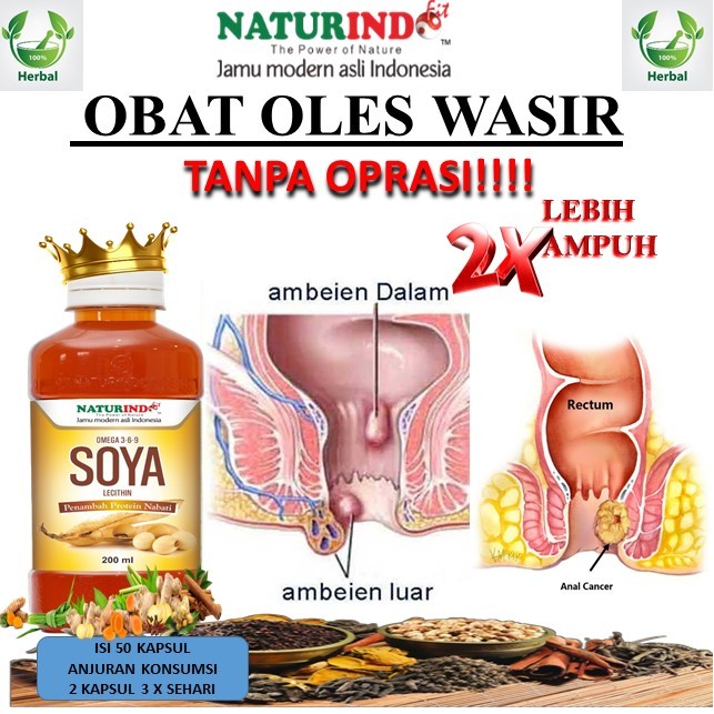 Obat wasir ambeien stadium 4 bab berdarah ampuh