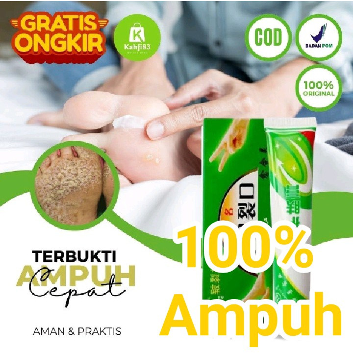 Obat Salep Kutu Air / Salep Kaki Rayapan / Salep Kaki Pecah - Pecah / Salep Kaki Bolong - Bolong