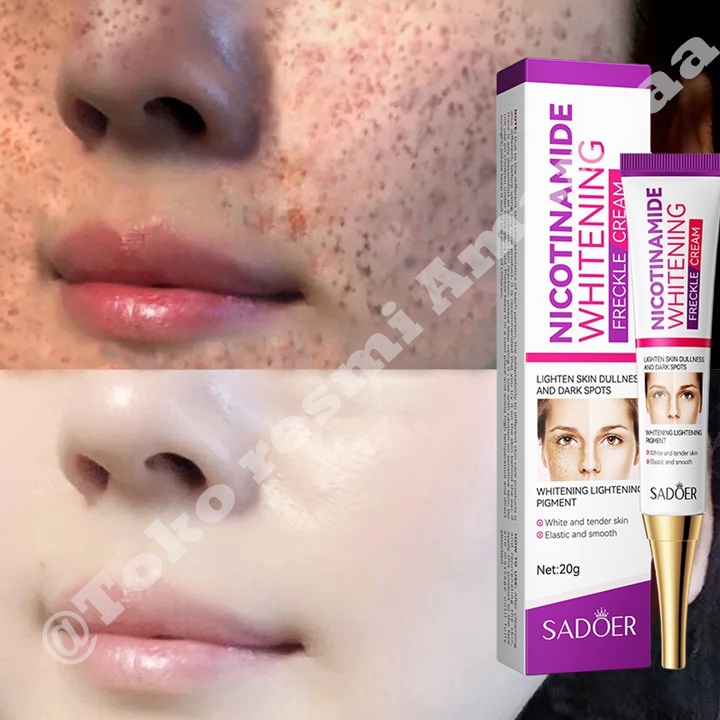 Niacinamide Cream Penghilang Flek Hitam Membandel Salep Pemutih Wajah Glowing Cepat 100% Ori Salep M