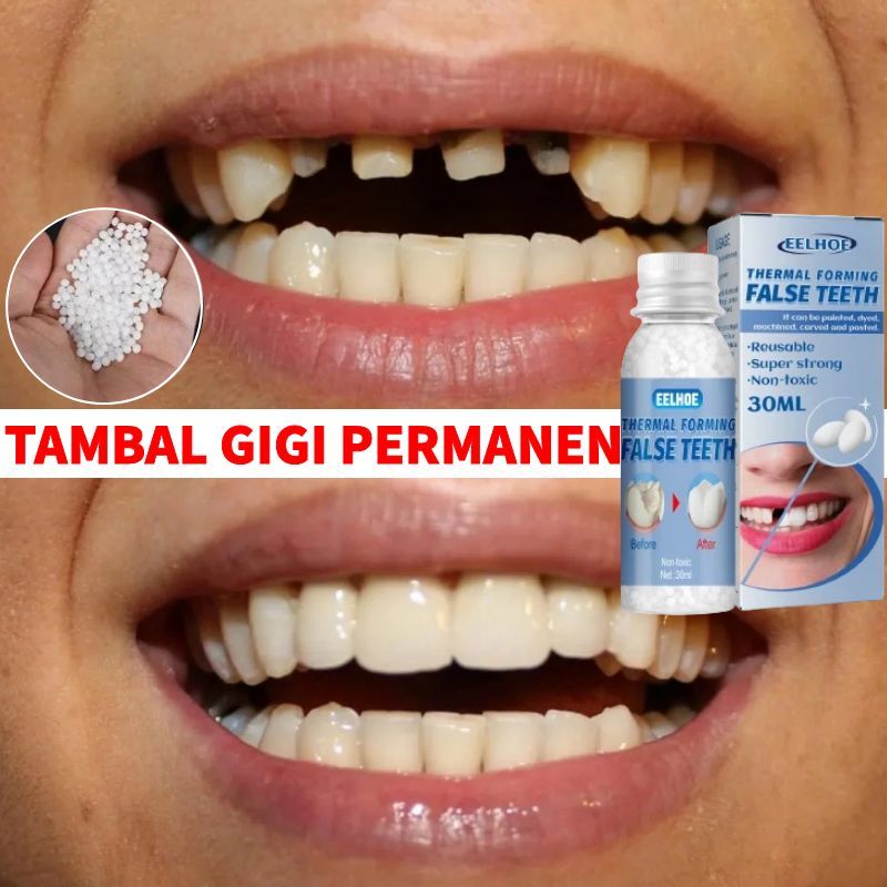 Gigi Palsu Penambal gigi berlubang Tambal gigi permanen Temptooth gigi palsu buat sendiri tambalan g