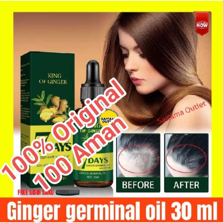 Penumbuh rambut botak cepat alami - Kebotakan Rambut Pria Kebotakan pria Perawatan Rambut Rontok 7D 