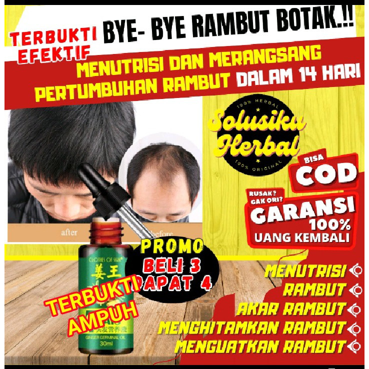 Serum 7 Days Clothes of Skin Penumbuh Penebal Penyubur Rambut Botak Cepat Alami Ginger Germinal Oil 