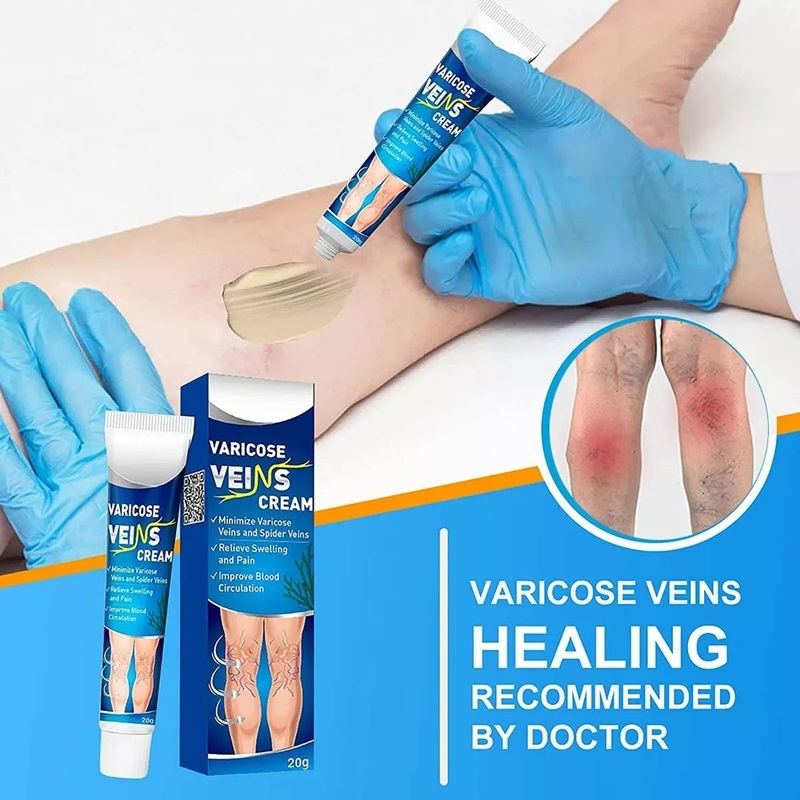 cream varises original Varicose Veins Cream Obat Varises Paling Ampuh Salep Penghilang Varises Vasku