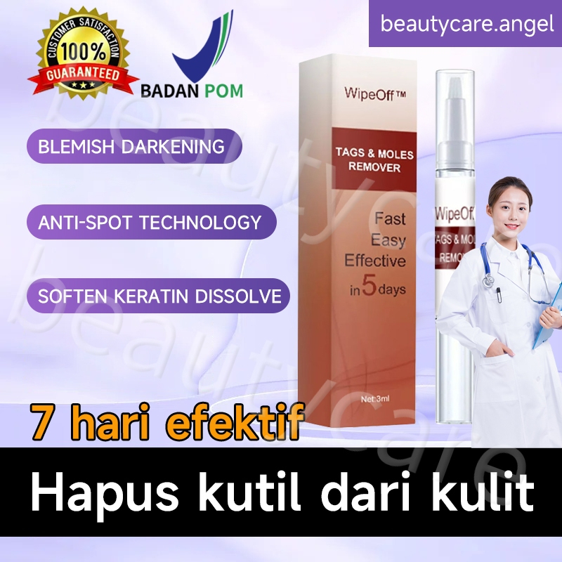 Penghilang Kutil Dan Tahi Lalat Penghilang Tahi Lalat penghilang kutil wart remover pembersih kutil 