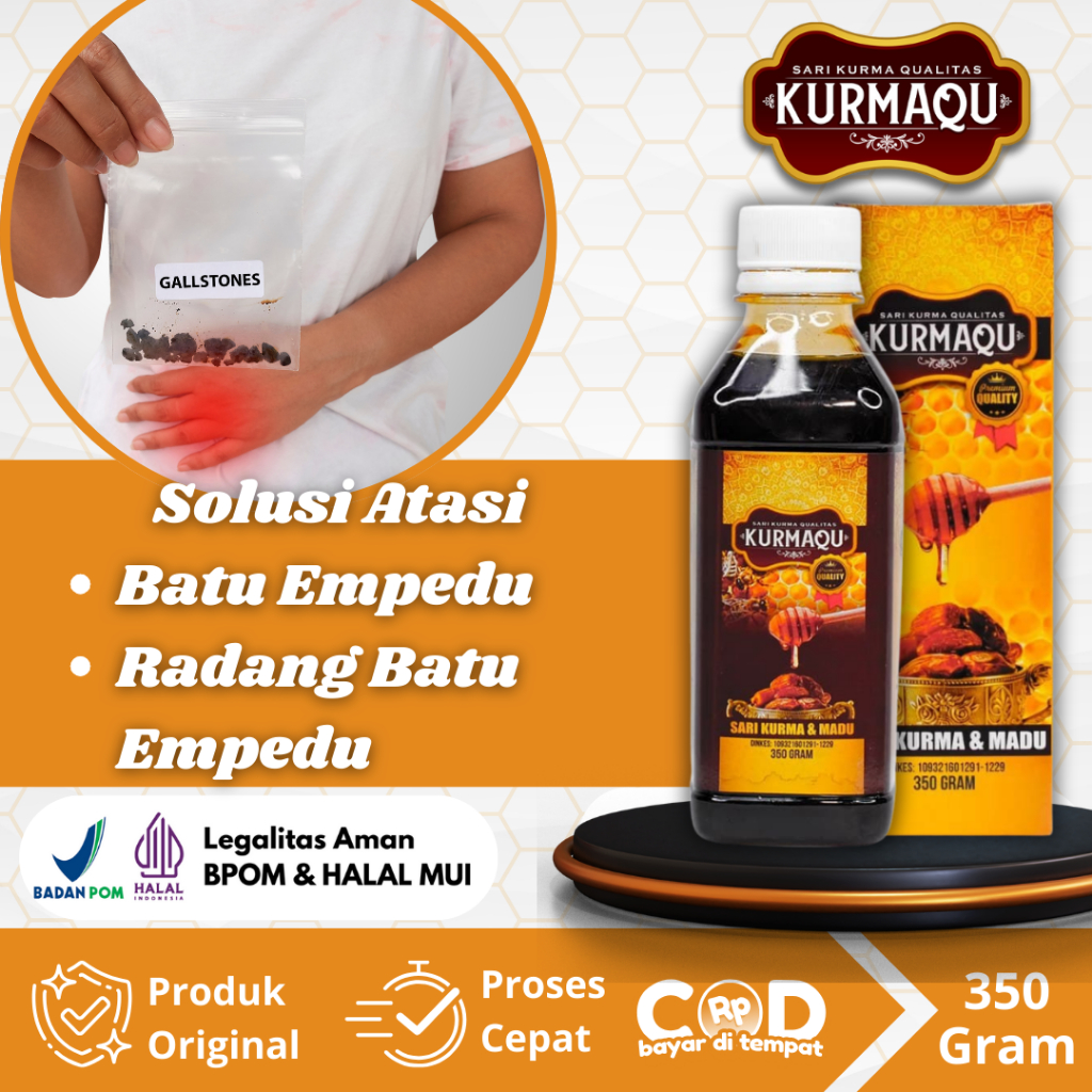 Obat Batu Empedu, Penghancur Batu Empedu, Radang Kantung Empedu, Sakit Empedu, Saluran Empedu Tersum