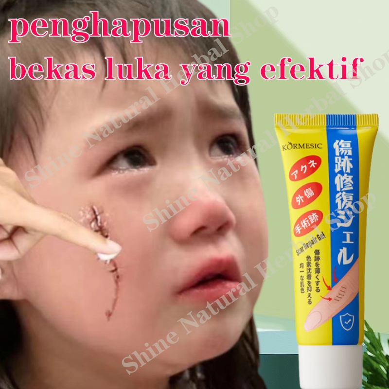 Penghilang Bekas Luka Salep40g Penghilang Bekas Luka Krim Surgical scar Hypertrophic scar Burn scar 