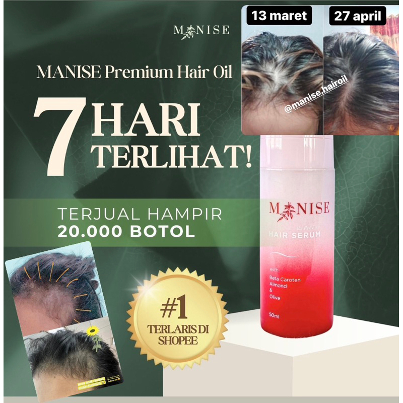 RONTOK BOTAK Penumbuh Rambut Manise Hair Oil tonic serum minyak rambut kemiri follow me shampoo loss