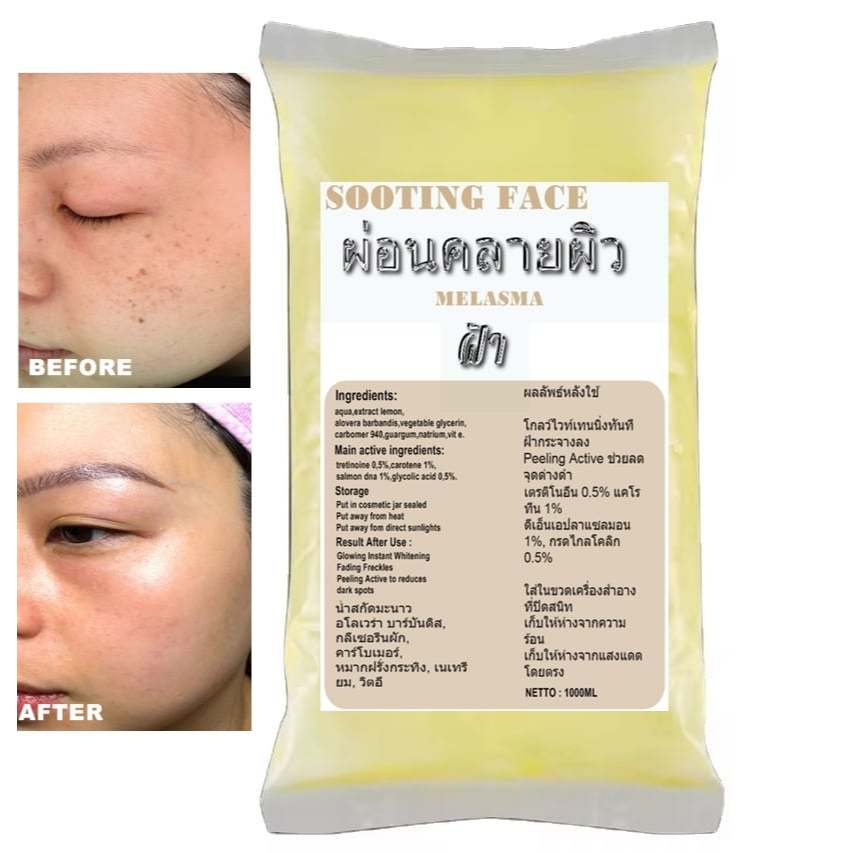 SOOTING KRIM PELICIN FLEK WAJAH THAILAND PELICIN GLOWING THAILAND 1LITER