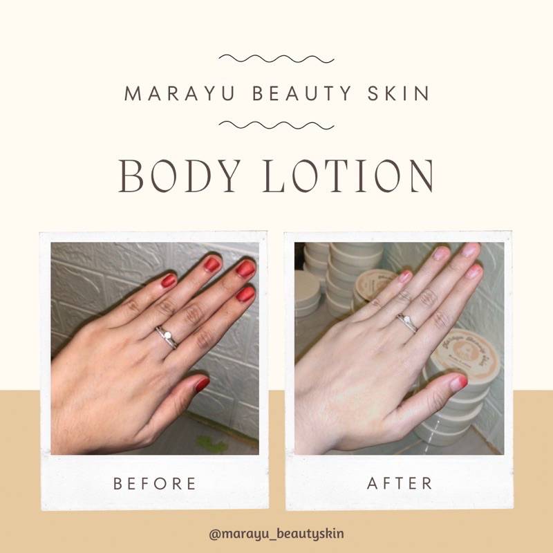 HB Dosting Marayu Beauty Skin