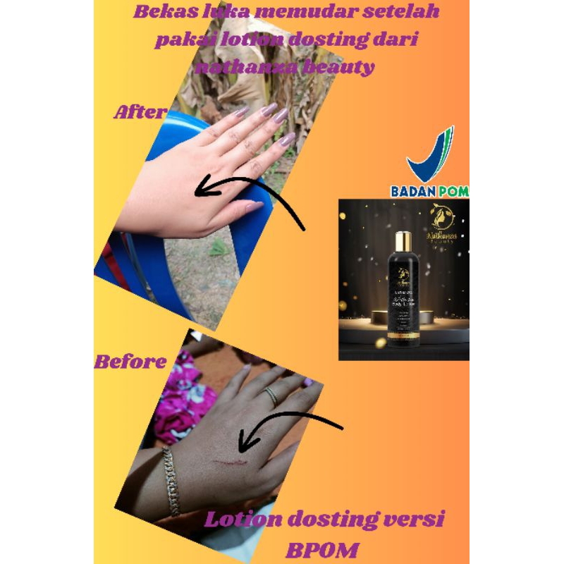 NATHANZA WHITENING BODY LOTION DOSTING