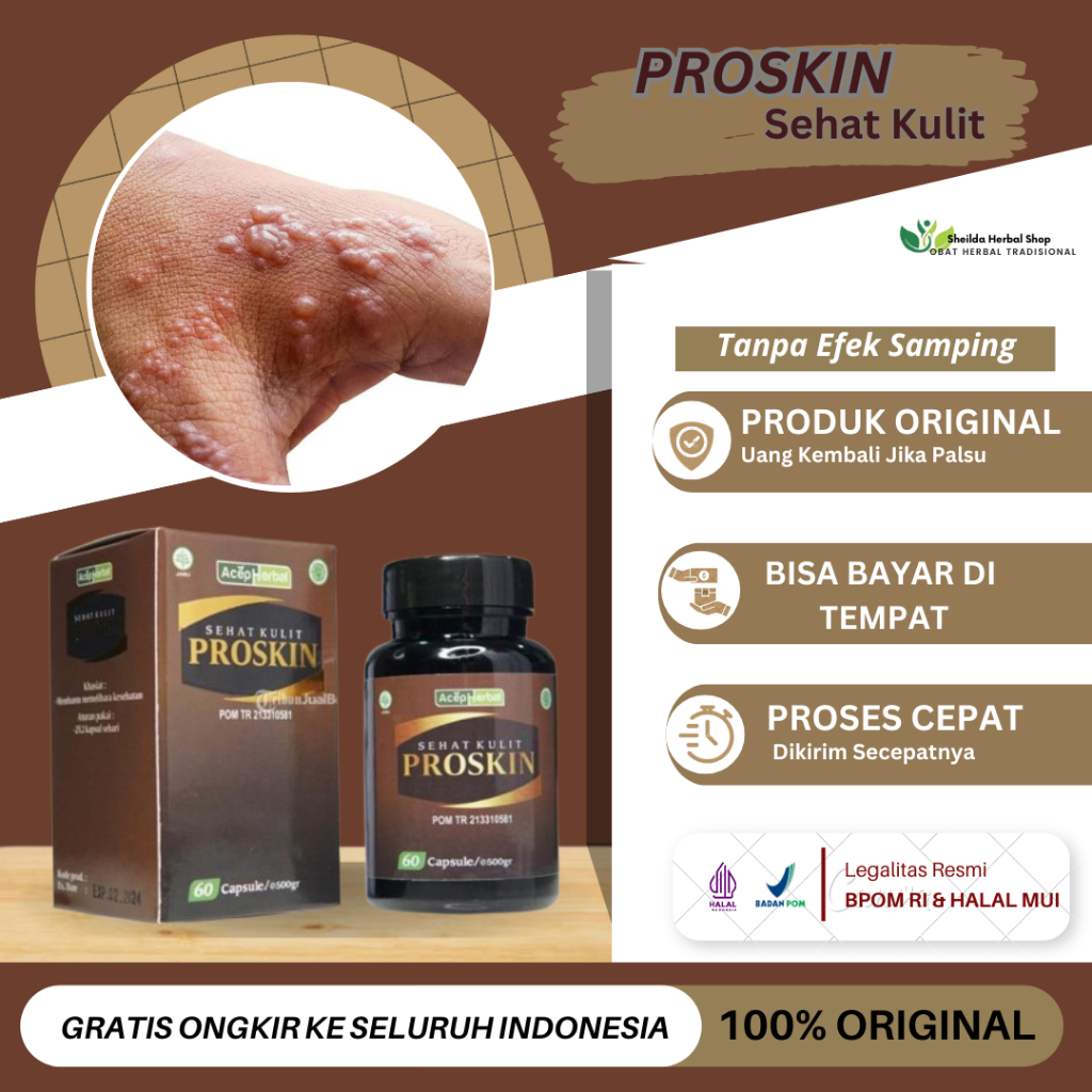 Proskin Gatal Kulit Herpes, Penyakit Kulit Herpes, Kulit Melepuh Gatal Berair, Gatal Herpes Genital