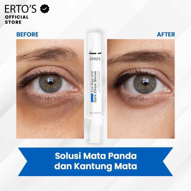ERTOS EYEBAG & DARK CIRCLE SERUM KANTUNG MATA ERTOS ORIGINAL