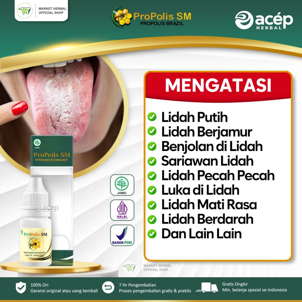 Obat Lidah Putih, Obat Lidah Berjamur, Obat Benjolan di Lidah, Obat Lidah Mati Rasa, Obat Lidah Peca