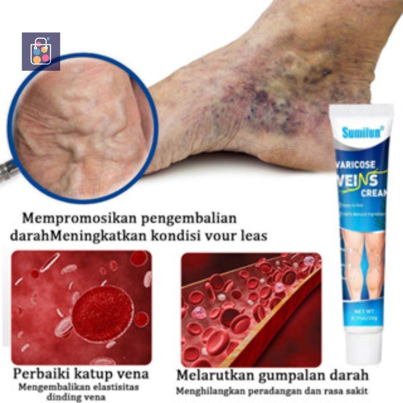 【ASLI】1 Box Obat Penghilang Parises - Salep Perawatan Koyo Varises Kelamin