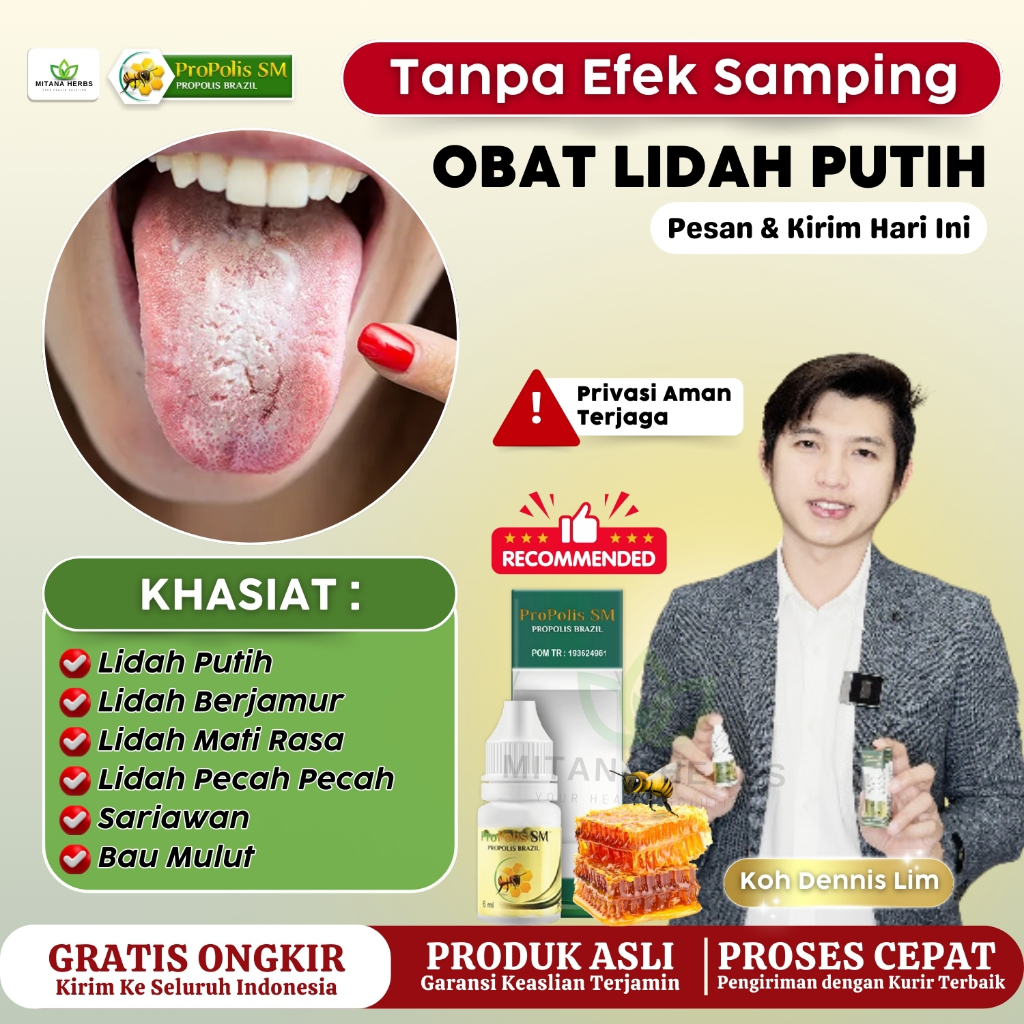 Obat Lidah Putih, Obat Lidah Putih Berjamur, Obat Lidah Pecah  Pecah, Lidah Mati Rasa Anak & Dewasa