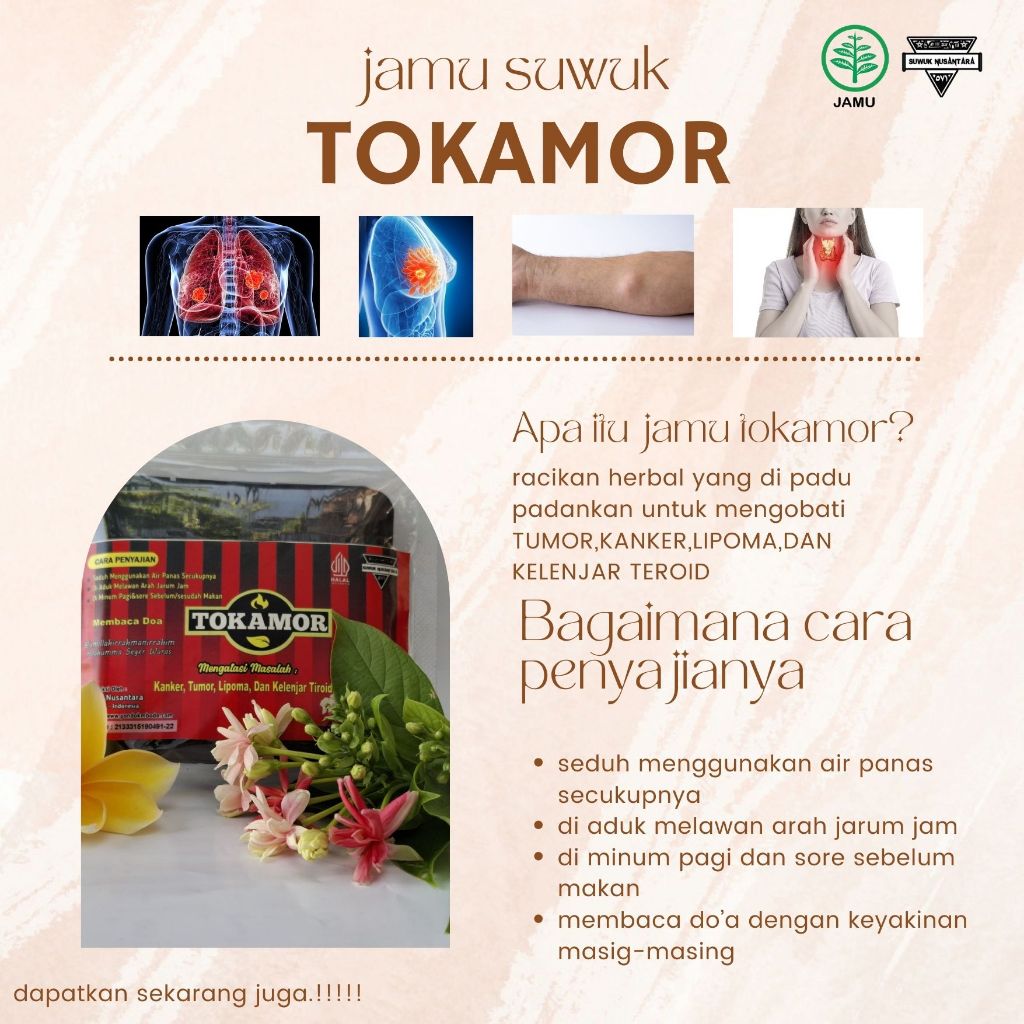 

JAMU TOKAMOR| pemberantas tumor dan kanker
