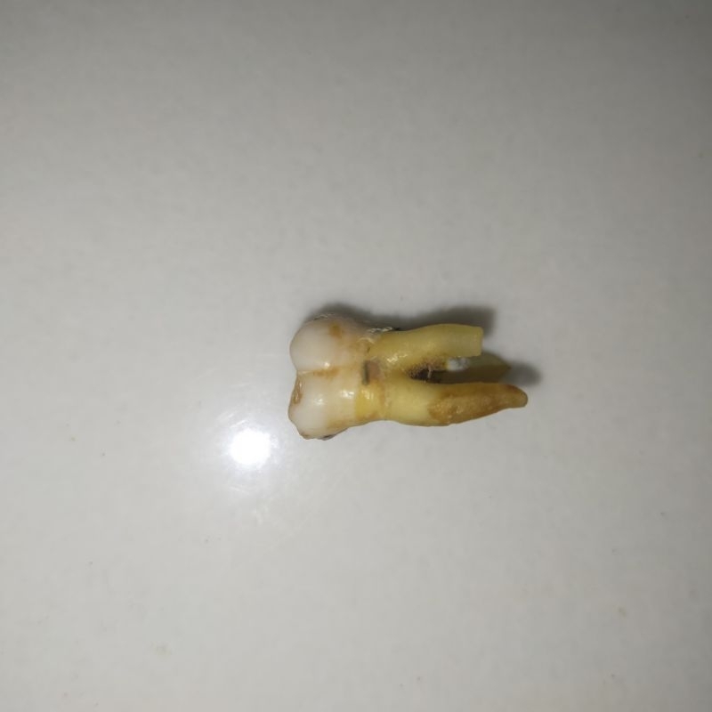 GIGI PRAKTIKUM  MOLAR ATAS/RAHANG ATAS/MOLAR