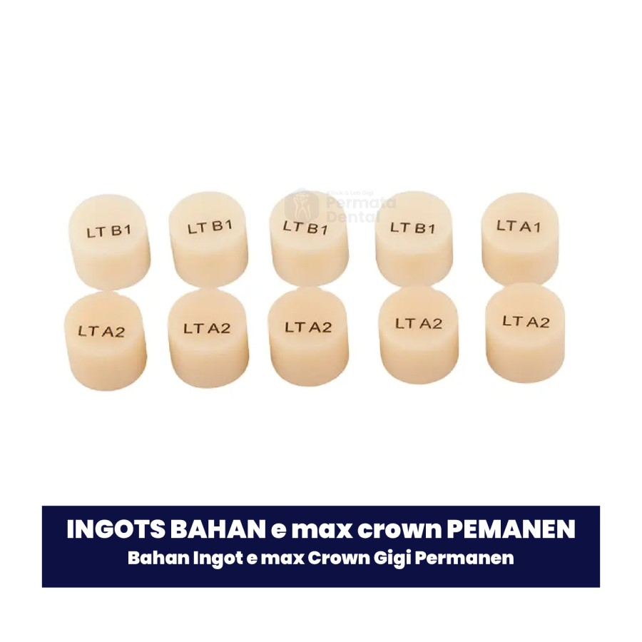 Bahan Ingot e max Crown Gigi Permanen
