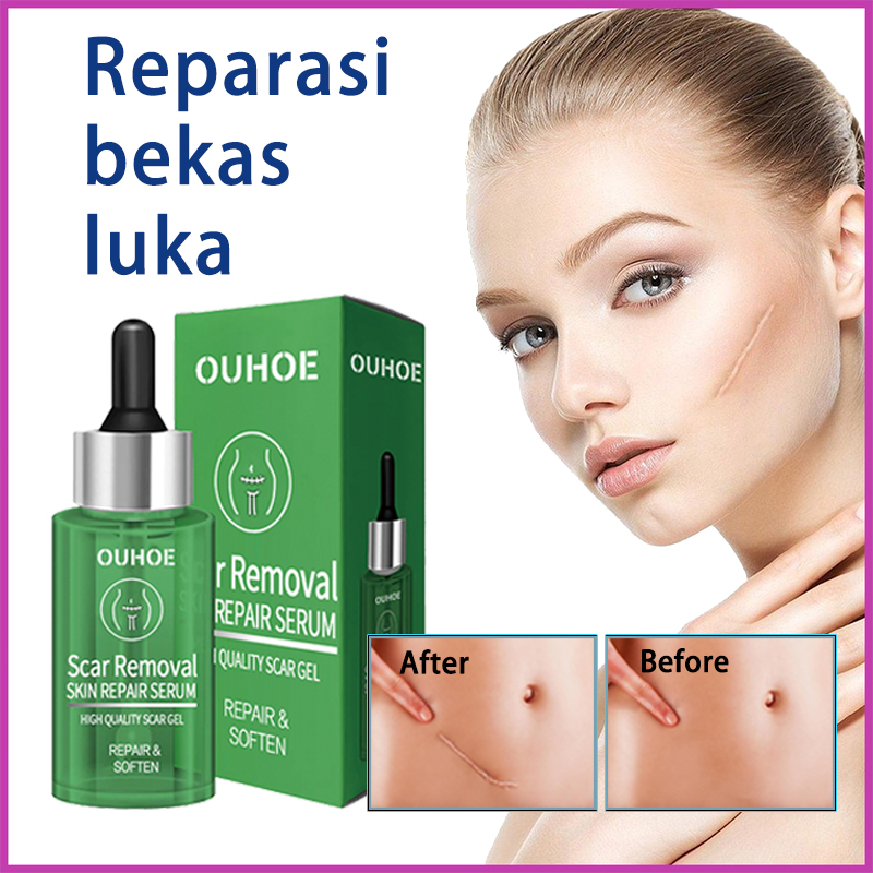 Salep penghilang bekas luka serum penghilang bekas luka Krim penghilang bekas luka operasi penghilan