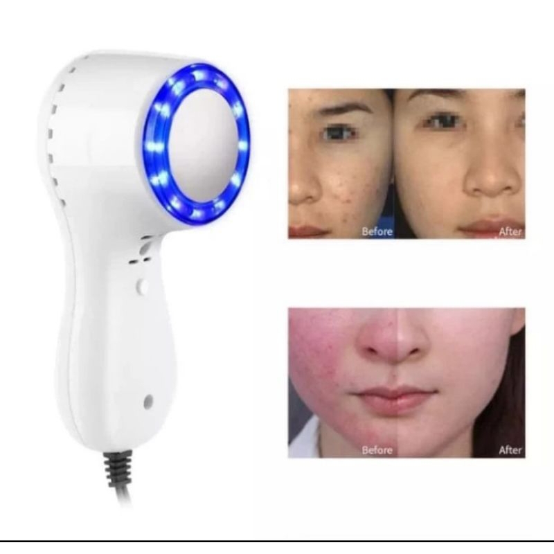 alat facial cold photon setrika wajah portabel