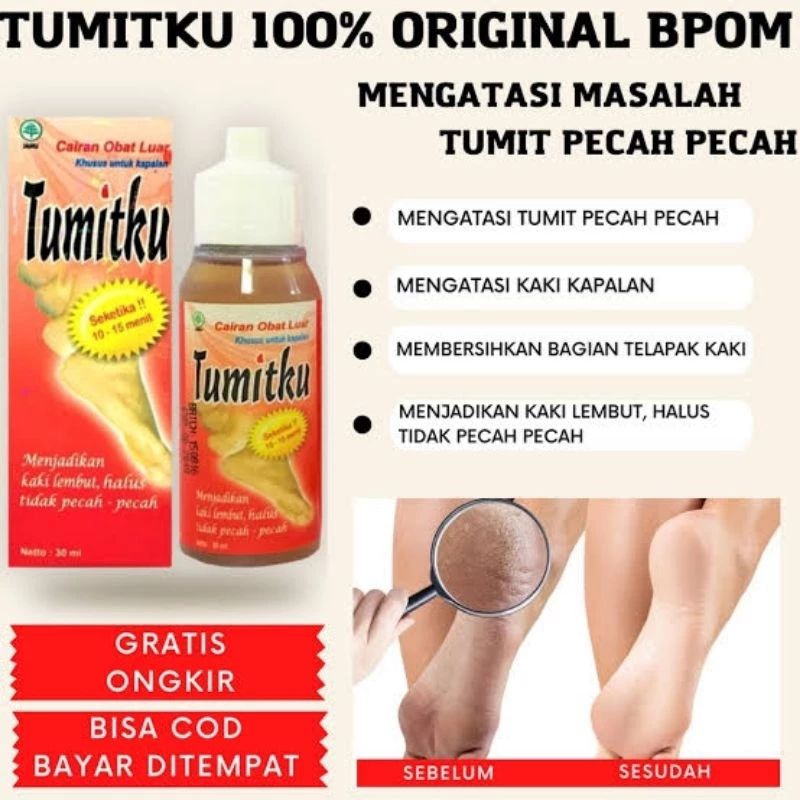 TUMITKU kaki pecah-pecah