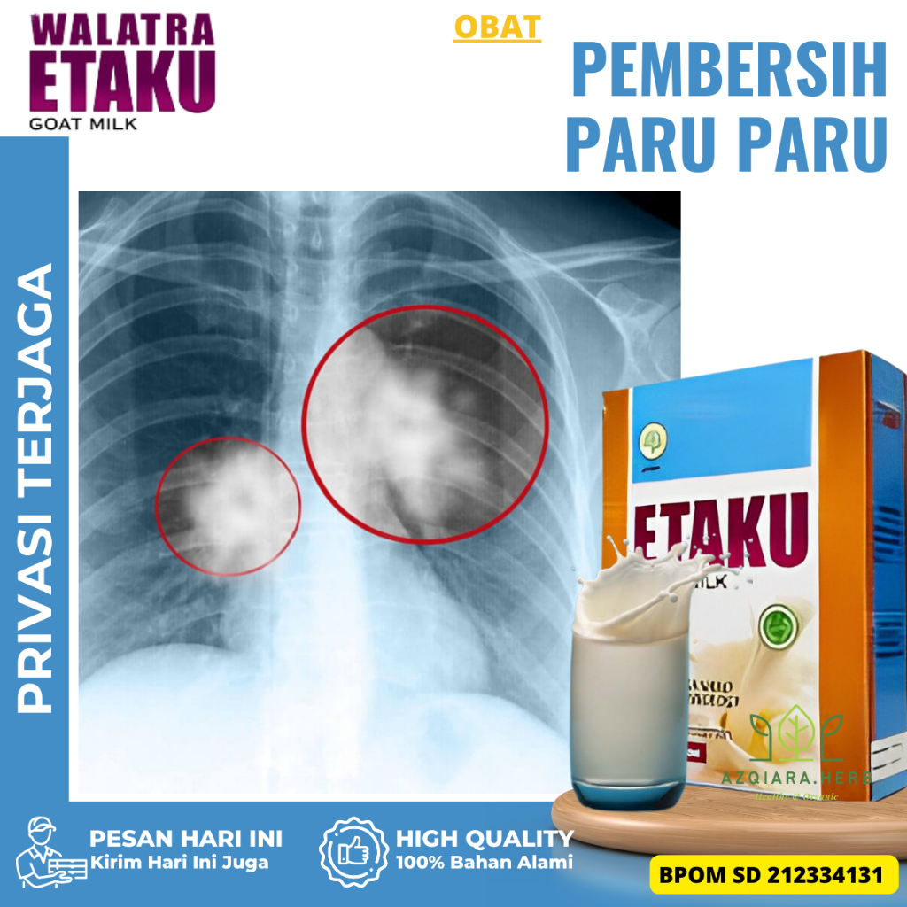 

Obat Flek Paru Paru, Susu Pembersih Paru Paru, Susu pembersih Paru Paru Kotor, obat Infeksi Paru Paru, Obat Bronkitis, Obat Asma Sesak Napas, Obat Radang Paru Paru, Obat ISPA, Obat Paru Paru Kotor Perokok - Walatra Susu Etaku Goat Milk