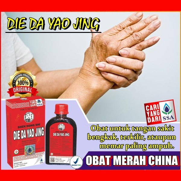 obat luka luar betadin cina obat merah china die da yao jing asli bpom mengobati tangan bengkak akib