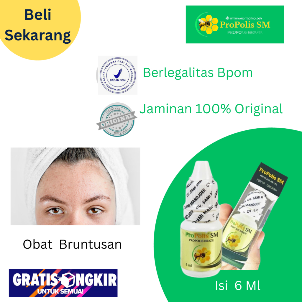 Salep Penghilang Bruntusan Di Wajah Bekas Jerawat, Obat Bruntusan Di Jidat, Obat Oles Bruntusan Dan 