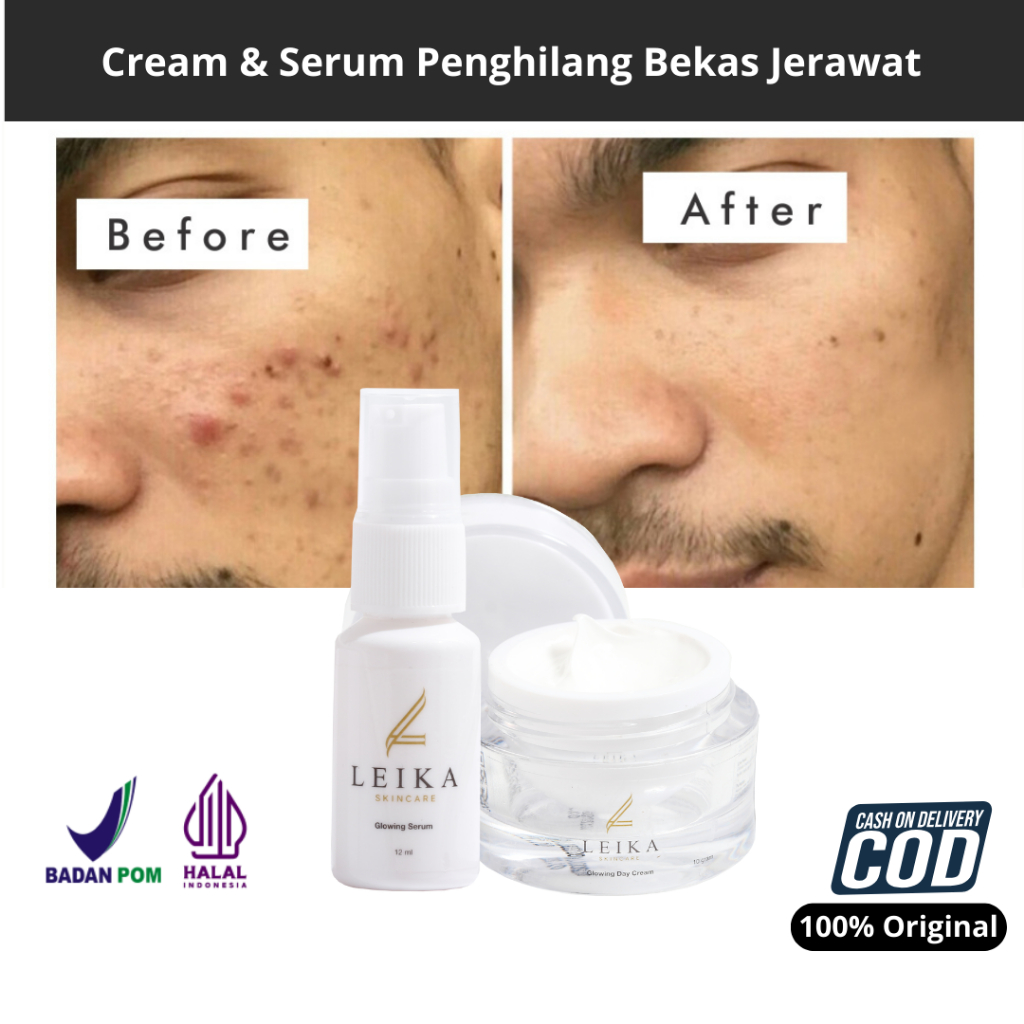 PAKET 2in1 [Day Cream & Serum] Penghilang Jerawat Ampuh Penghilang Jerawat Pria Penghilang Bekas Jer