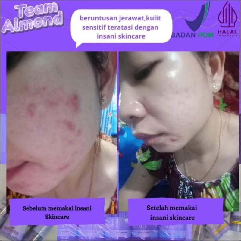 Insani Skincare bpom/klinik