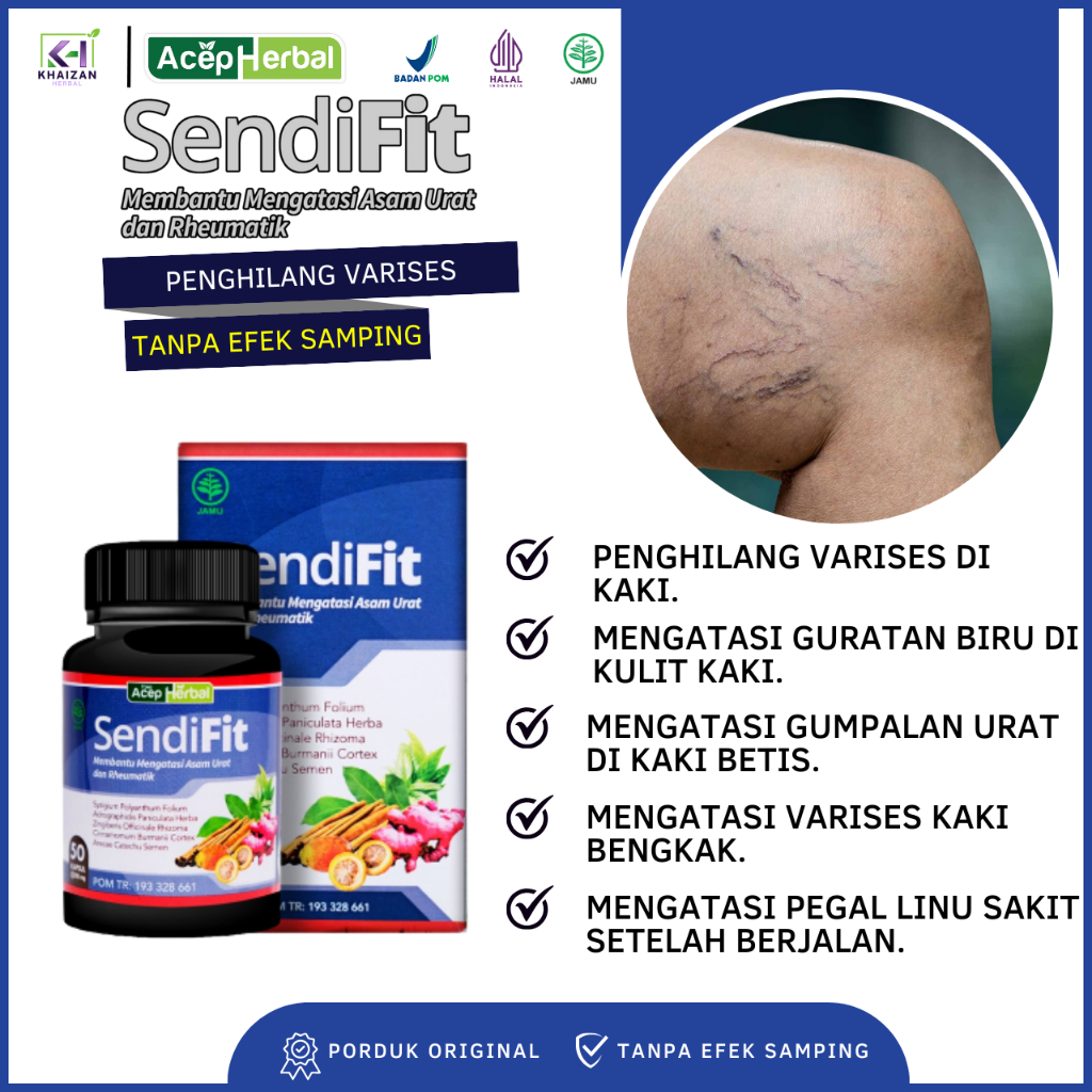 Obat Penghilang Varises Kaki dgn Herbal Sendifit Atasi Obat Varises di Betis Kaki, Guratan Biru di K
