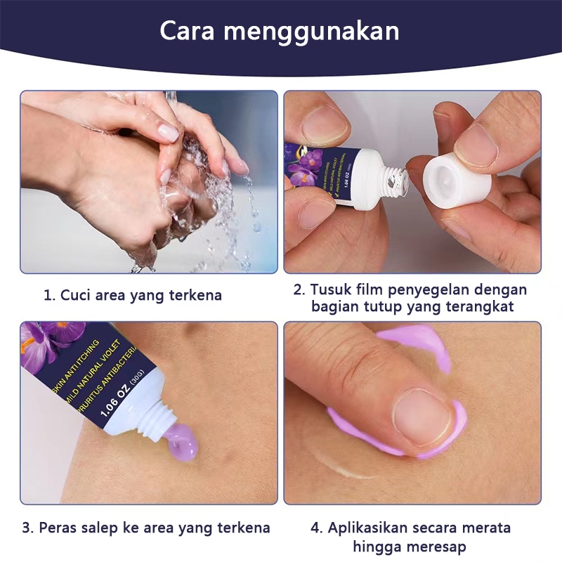 Salep jamur kulit salep eksim salep gatal paling ampuh salep gatal 30g Kulit Kepala Psoriasis Tangan Tinea Kaki Bau Versicolor Menghambat Dermatitis Jamur Anti Gatal Cream Menghambat Dermatitis Jamur Anti Gatal Cream