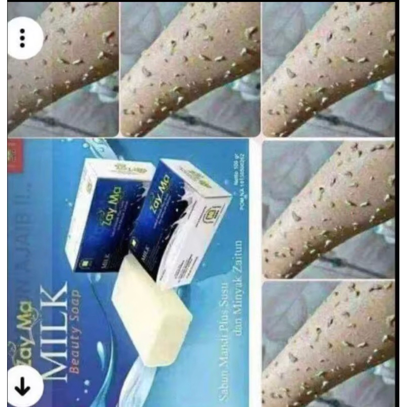 Sabun perontok daki dan pemutih wajah dan badan[Zayma susu pemutih]
