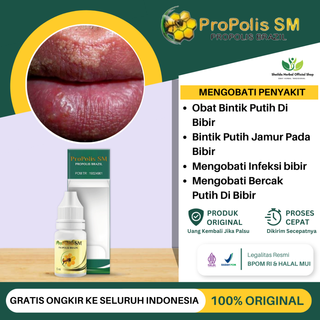 Obat Bintik Putih Di Bibir, Penghilang Bercak Putih Di Bibir, Bibir Bintik Berair, Bintik Putih Jamu